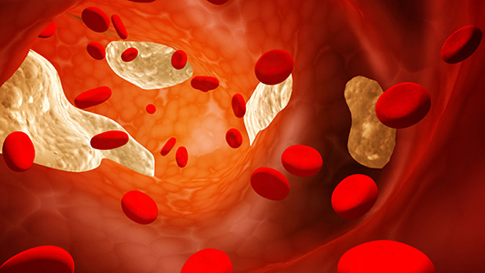 Does CoQ10 Lower Cholesterol
